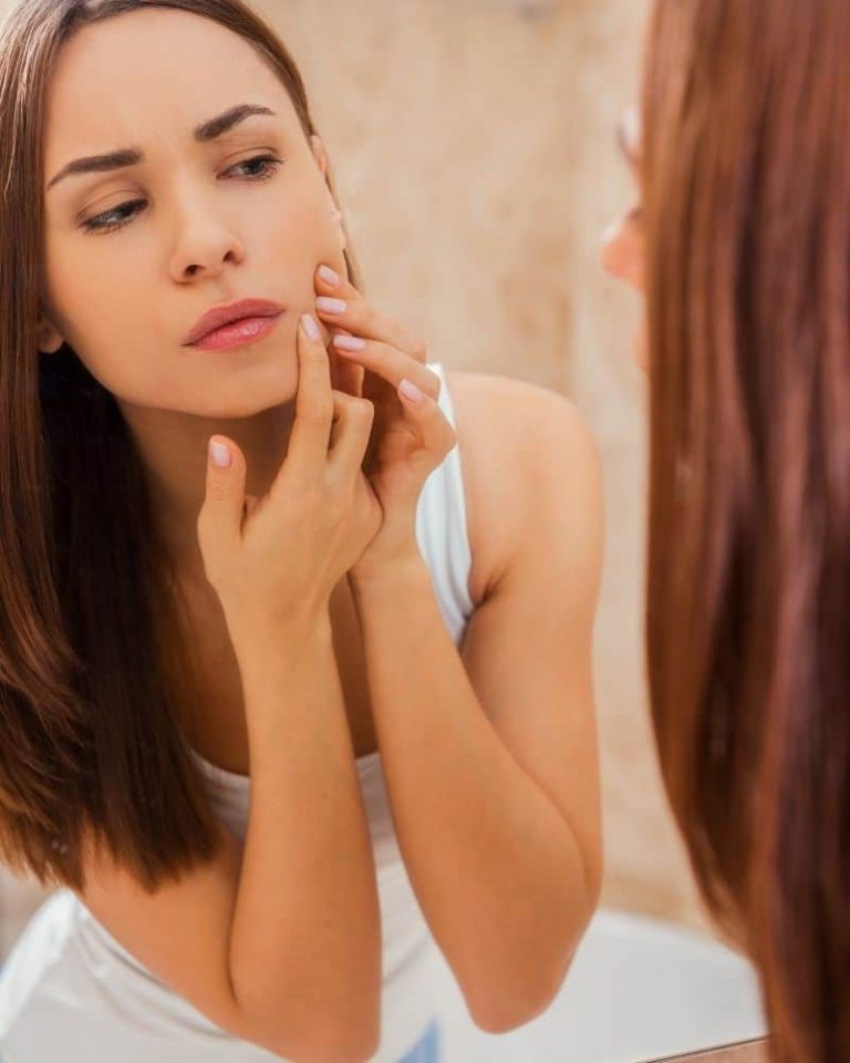 what causes fungal acne vs closed comedones